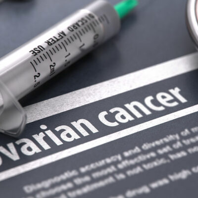 6 Complications of Ovarian Cancer