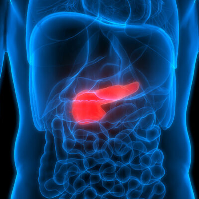 7 Early Warning Signs of Pancreatic Cancer