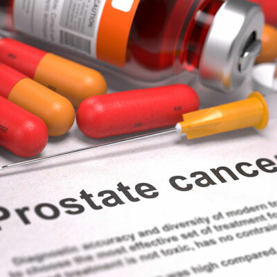 Causes and Risk Factors of Prostate Cancer
