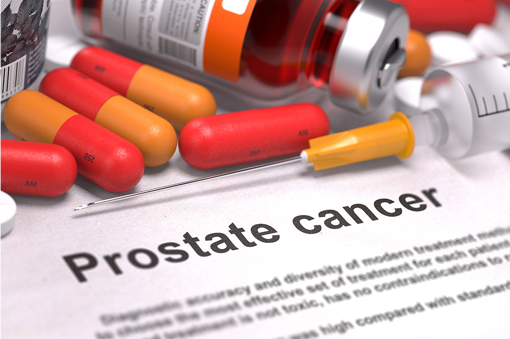 Causes and Risk Factors of Prostate Cancer