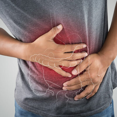 Ulcerative Colitis – Symptoms and Trigger Foods
