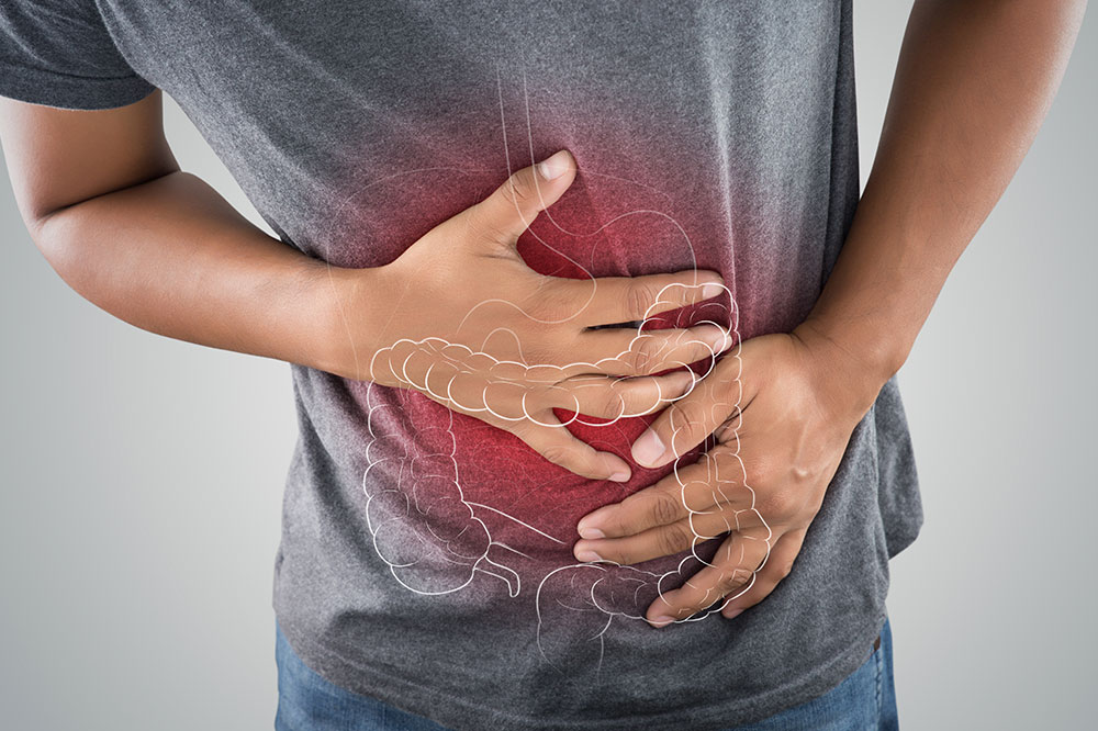 Ulcerative Colitis – Symptoms and Trigger Foods